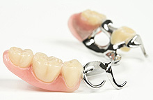 Klammerprothes - herausnehmbarer Zahnersatz Zahnarztpraxis A. Lassman Mannheim Zentrum